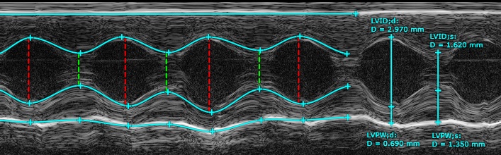 Analysis of Cardiac Function in BPTF KD Mice Using M-Mode Echocardiography